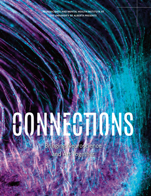 University of Alberta - Connections NMHI Book
